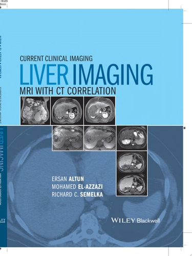 Liver Imaging MRI with CT Correlation cover