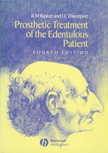 Prosthetic Treatment of the Edentulous Patient cover