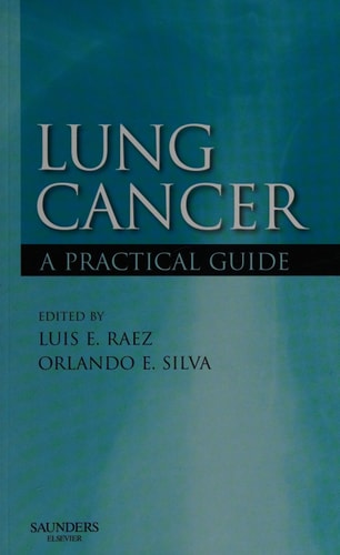 Lung Cancer A Practical Guide cover