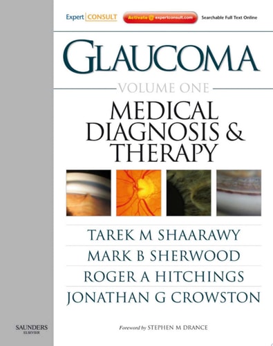 Glaucoma Expert Consult Premium Edition - Enhanced Online Features, Print, and DVD, 2-Volume Set cover