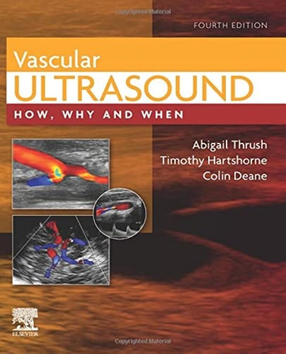 Vascular Ultrasound How, Why and When cover