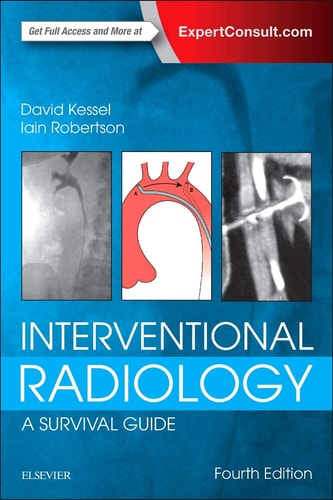 Interventional Radiology A Survival Guide cover
