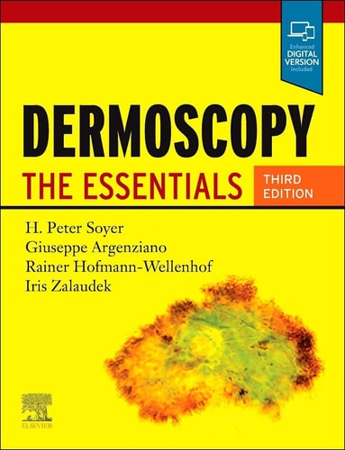Dermoscopy The Essentials cover