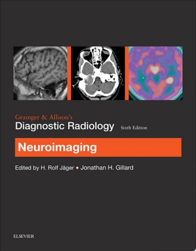 Grainger & Allison's Diagnostic Radiology: Neuroimaging cover