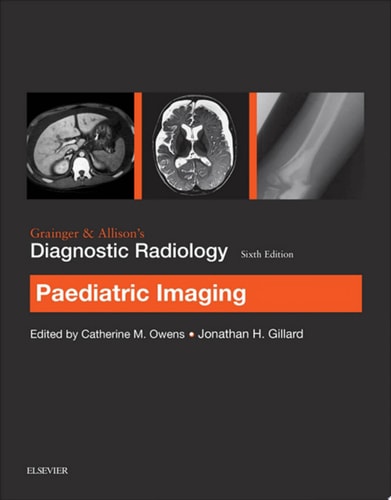 Grainger & Allison's Diagnostic Radiology: Paediatric Imaging cover
