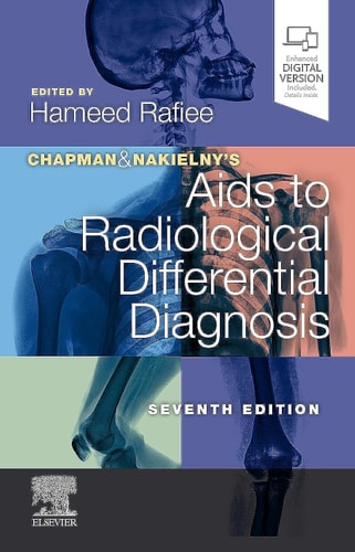 Chapman & Nakielny's Aids to Radiological Differential Diagnosis cover