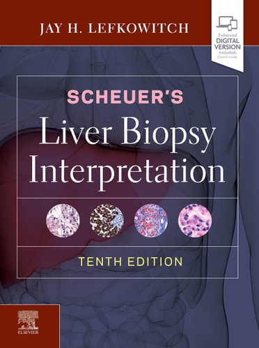 Scheuer's Liver Biopsy Interpretation cover