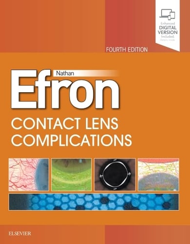 Contact Lens Complications cover