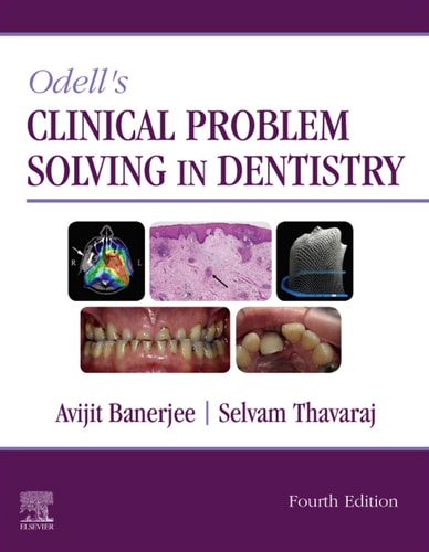 Odell's Clinical Problem Solving in Dentistry Elsevier eBook on VitalSource cover