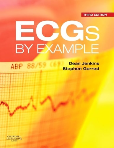 ECGs by Example cover
