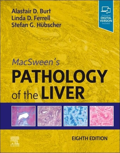 MacSween's Pathology of the Liver cover