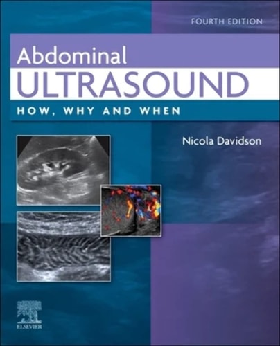Abdominal Ultrasound How, Why and When cover