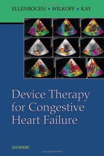 Device Therapy for Congestive Heart Failure cover