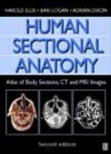 Human Sectional Anatomy, 2Ed Atlas of Body Sections, CT and MRI Images cover