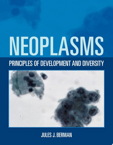 Neoplasms: Principles of Development and Diversity cover