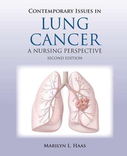 Contemporary Issues in Lung Cancer cover
