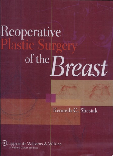 Reoperative Plastic Surgery of the Breast cover