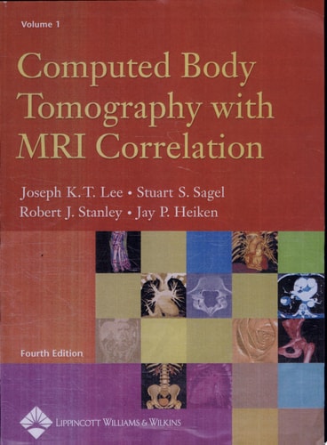 Computed Body Tomography with MRI Correlation cover