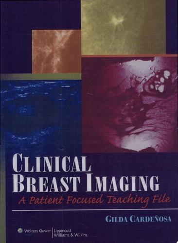 Clinical Breast Imaging A Patient Focused Teaching File cover