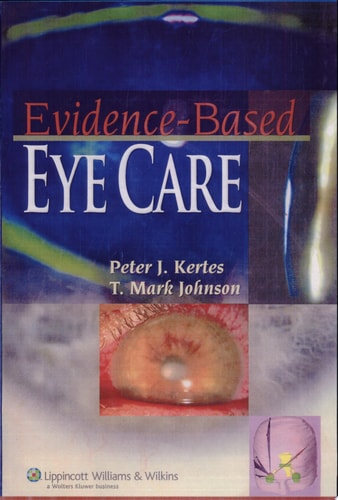 Evidence-based Eye Care cover