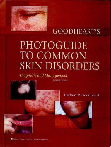 Goodheart's Photoguide to Common Skin Disorders Diagnosis and Management cover