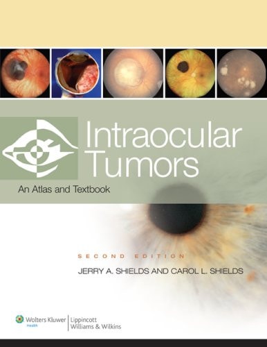 Intraocular Tumors An Atlas and Textbook cover