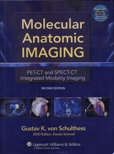 Molecular Anatomic Imaging PET-CT and SPECT-CT Integrated Modality Imaging cover