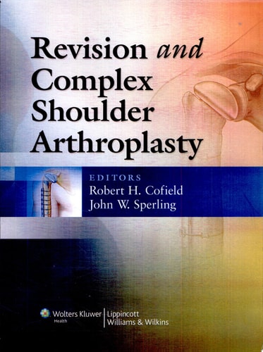 Revision and Complex Shoulder Arthroplasty cover
