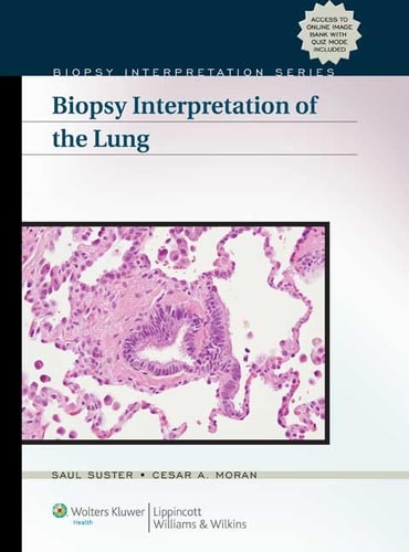 Biopsy Interpretation of the Lung cover