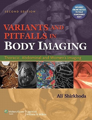 Variants and Pitfalls in Body Imaging Thoracic, Abdominal and Women's Imaging cover