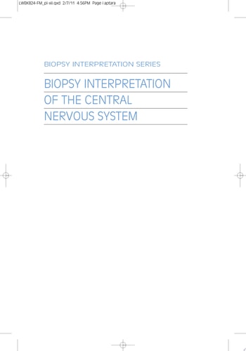 Biopsy Interpretation of the Central Nervous System cover