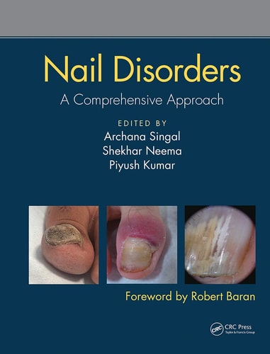 Nail Disorders A Comprehensive Approach cover