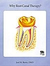 Why Root Canal Therapy? (Educate Your Patients) cover
