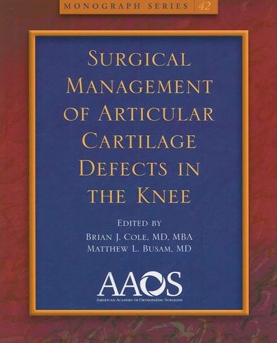 Surgical Management of Articular Cartilage Defects in the Knee cover
