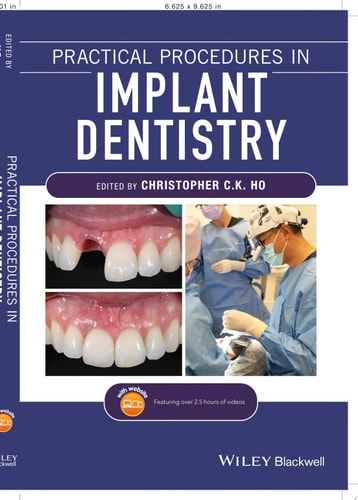 Practical Procedures in Implant Dentistry cover