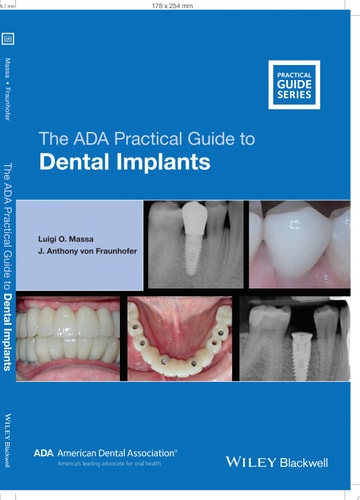 The ADA Practical Guide to Dental Implants cover