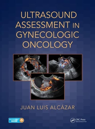 Ultrasound Assessment in Gynecologic Oncology cover