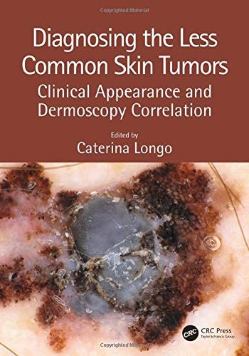 Diagnosing the Less Common Skin Tumors Clinical Appearance and Dermoscopy Correlation cover
