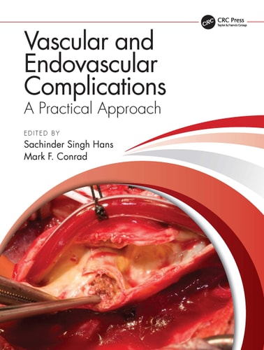Vascular and Endovascular Complications A Practical Approach cover
