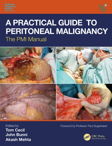 A Practical Guide to Peritoneal Malignancy The PMI Manual cover