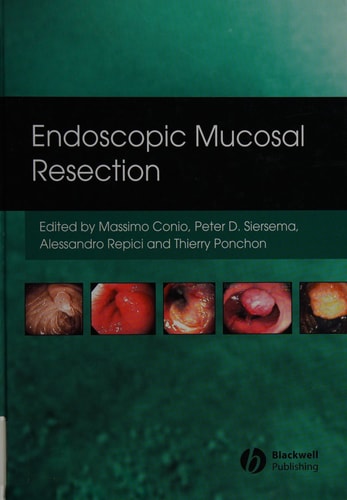 Endoscopic Mucosal Resection cover