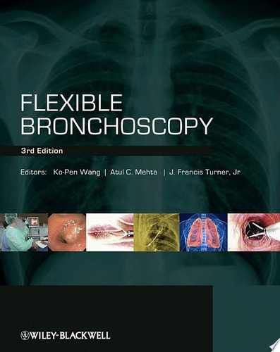 Flexible Bronchoscopy cover