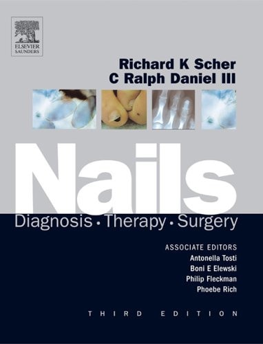 Nails: Diagnosis, Therapy, Surgery cover