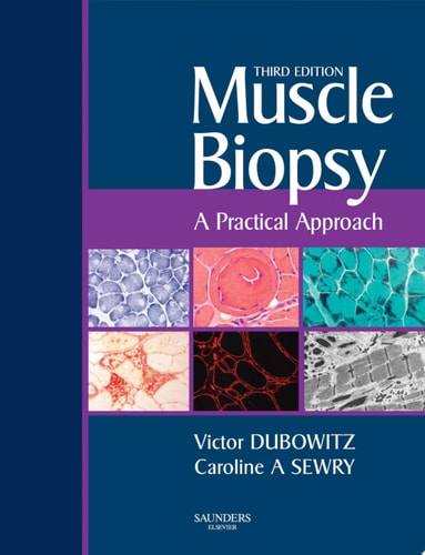 Muscle Biopsy A Practical Approach cover