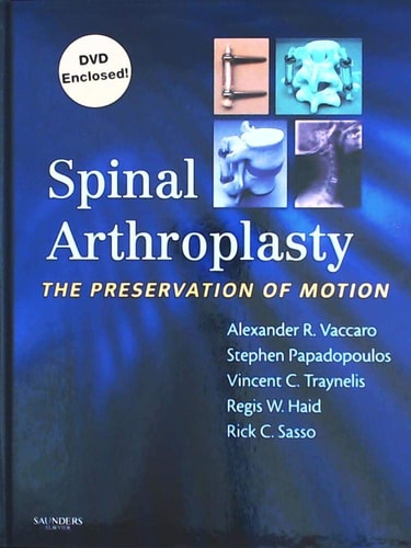 Spinal Arthroplasty The Preservation of Motion cover