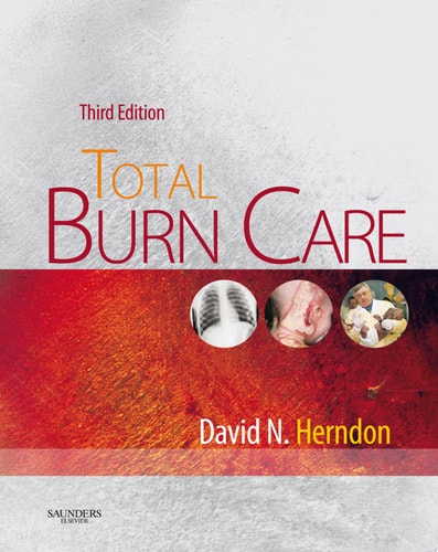 Total Burn Care cover