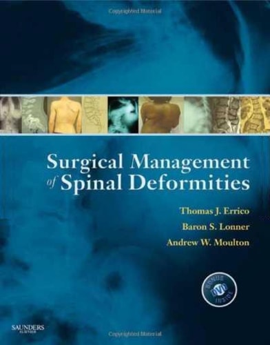 Surgical Management of Spinal Deformities cover