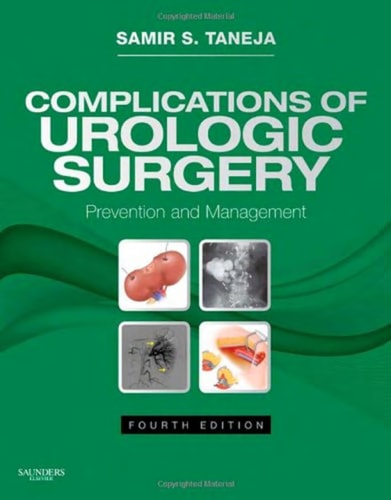 Complications of Urologic Surgery Prevention and Management cover