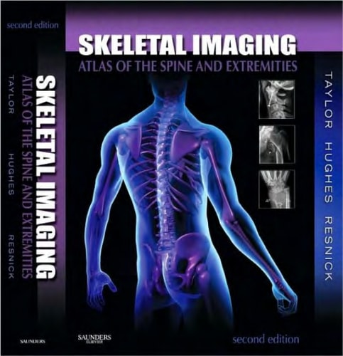 Skeletal Imaging Atlas of the Spine and Extremities cover