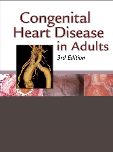 Congenital Heart Disease in Adults cover